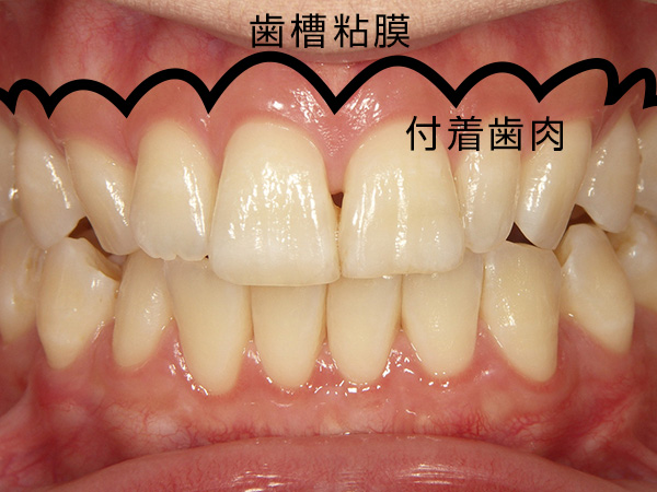 歯茎の構造