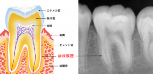 歯と神経の関係図