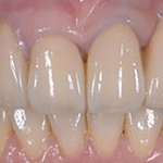 審美歯科の症例写真