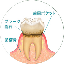 歯周組織の検査